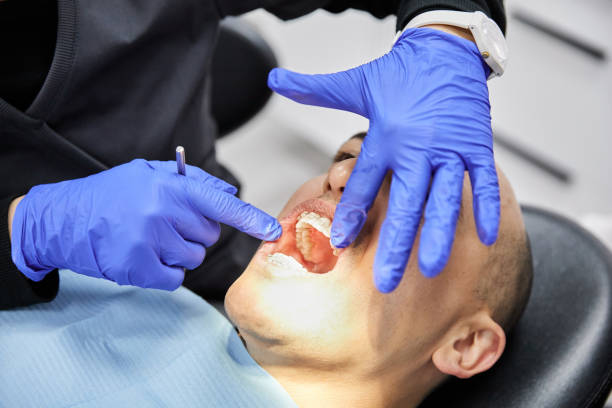 Best Emergency Root Canal Treatment in Wynnewood, OK